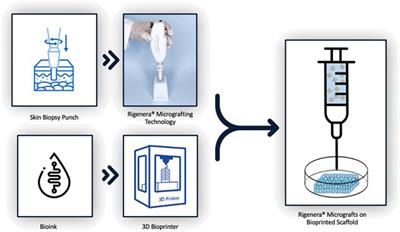 3D bioprinting and Rigenera® micrografting technology: A possible countermeasure for wound healing in spaceflight